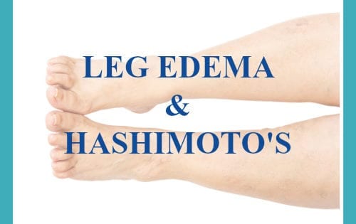 hashimoto-s-leg-swelling