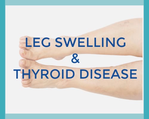 Can Thyroid Cause Swelling In Legs And Feet