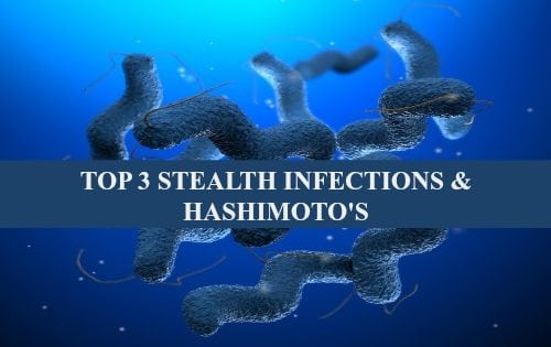 Top 3 Stealth Infections Hashimoto's